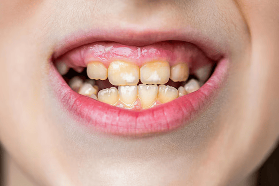 Een complete gids voor mondhygiëne: 10 bewezen manieren om je tanden gezond, schoon en vrij van gaatjes te houden.