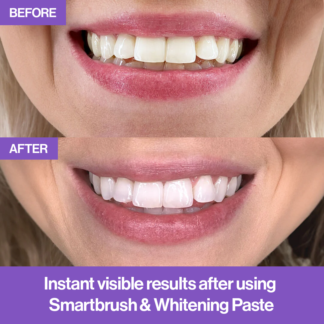 GlowSmile™ - Smartbrush